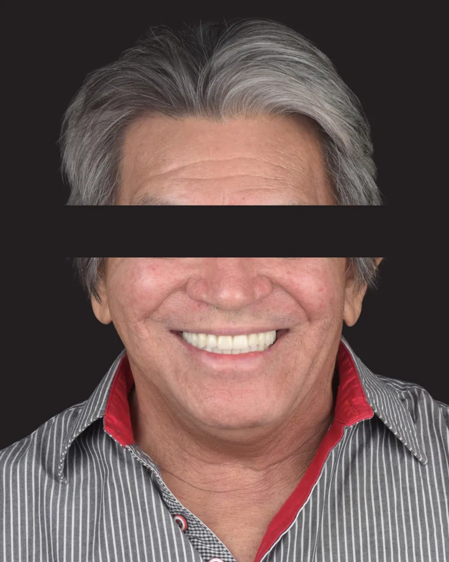 Depois